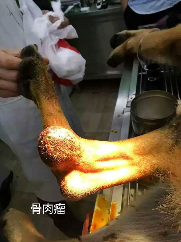 骨肉瘤1.jpg