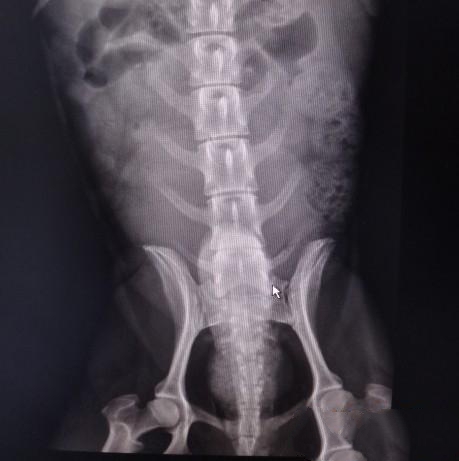 图2  第六、七腰椎间隙狭窄，肠管内积气积粪