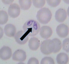 犬巴贝斯虫，寄生在红细胞中，曾锐角、梨状成对排列，4um7um。箭头方向