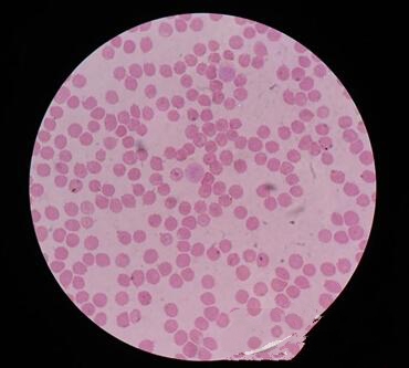 血涂片箭头所指巴贝斯虫红细胞内有黑色圆点，个别红细胞形状发生改变。
