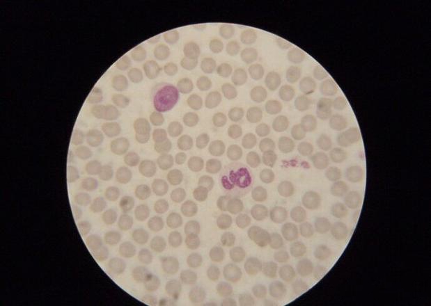 图5 正常的犬红细胞的形态