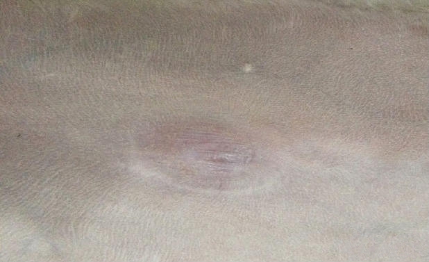 患有脐疝的犬，被救助的白色泰迪，可以看见其脐部有一明显的脐孔，触诊时可以明显感到脐孔的存在，且内容可以还纳于腹腔内。脐孔部皮肤较薄。