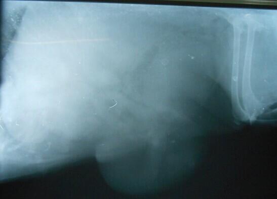   X光下腹部肿瘤