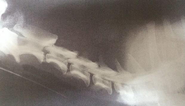 图4.3 A 正常颈椎造影X线片
